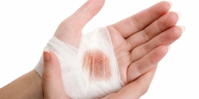 WOUND HEALING: HOW TO PROPERLY HEAL?