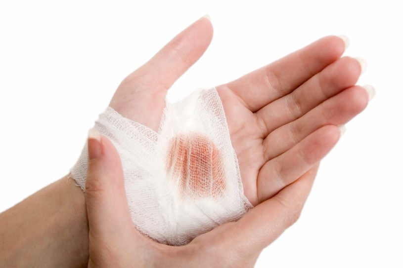 WOUND HEALING: HOW TO PROPERLY HEAL?
